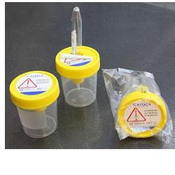 CONTENITORE PER URINA DA 120ML TAPPO A VITE CON DISPOSITIVO DI PRELIEVO DA PROVETTA SOTTOVUOTO IN POLIPROPILE - farmaidea24.com