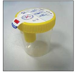 KIT CONTENITORE URINA SECUR BOX TAPPO GIALLO A VITE CON PUNTO DI PRELIEVO 120 ML 1 PEZZO - farmaidea24.com